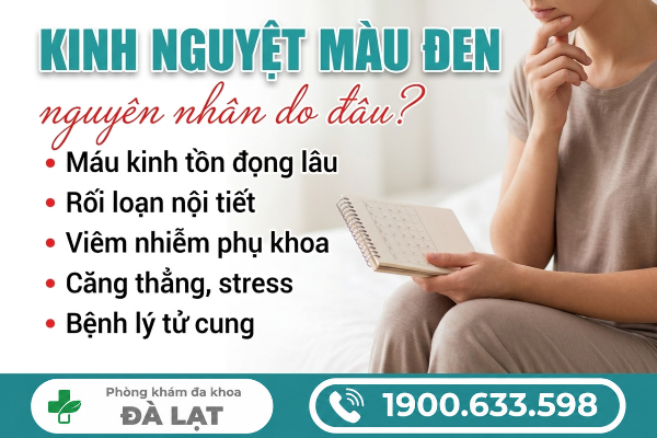 Hình ảnh minh họa